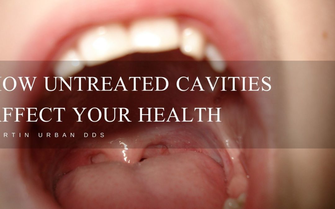 How Untreated Cavities Affect Your Health